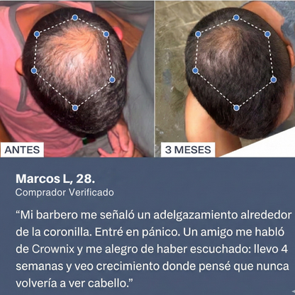 Kit Crecimiento Total