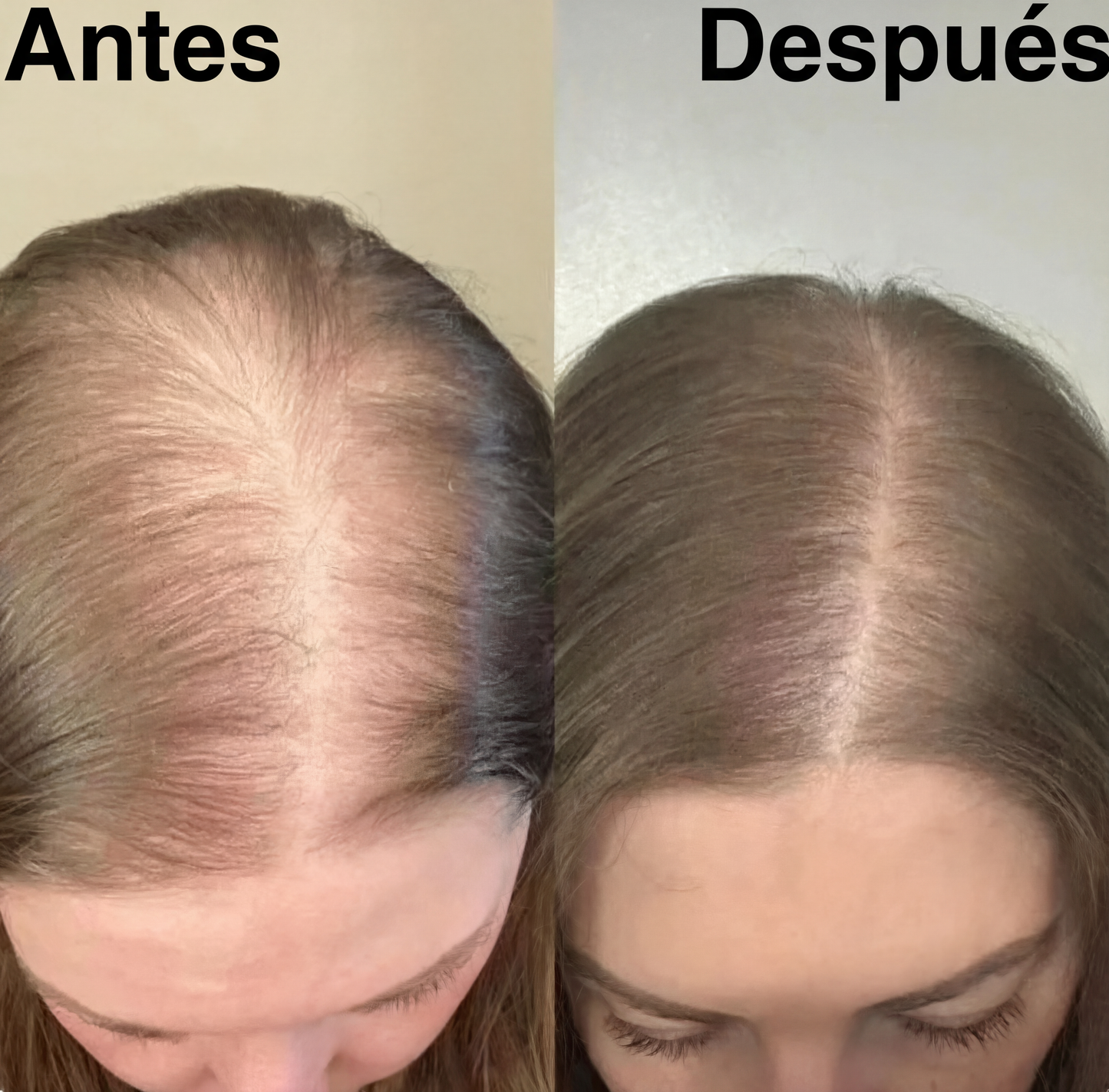 Champú orgánico de romero para el crecimiento del cabello